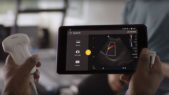 Philips Lumify - Ecografia a portata di mano sul vostro smart device compatibile