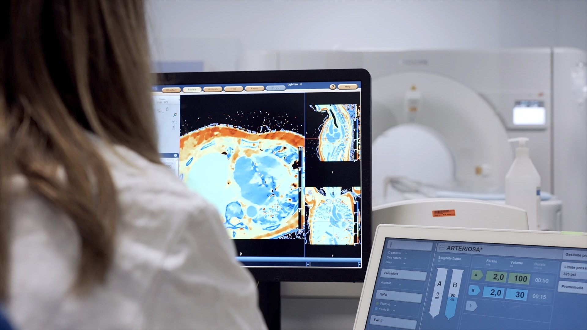 Foto di un medico che imposta una scansione sul gantry dello scanner TC, con il paziente sul lettino paziente del sistema TC
