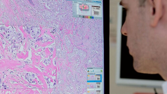 L'anatomia patologica diventa digitale