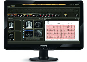 Tracciato elettrocardiografico monitorato attraverso la soluzione Philips CVIS