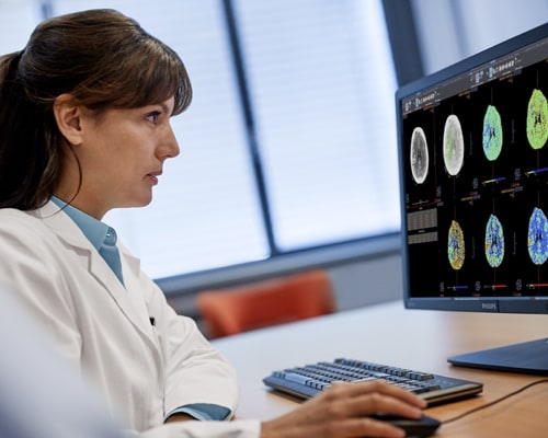 Diagnostic viewer, medico che guarda le immagini relative a perfusione RM