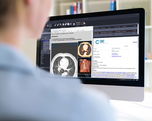 Diagnostic viewer, medico che guarda le immagini relative a perfusione RM