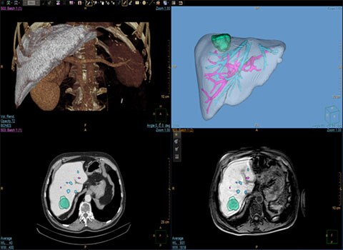 immagine clinica 3D Modeling