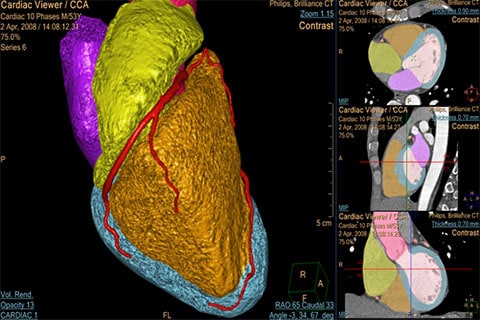 immagine clinica ct comprehensive cardiac analysis