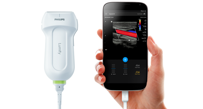 Philips Lumify Portable Ultrasound Solution