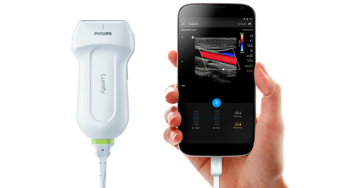 Soluzione ecografica portatile Philips Lumify