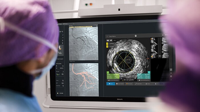 Cardiologi che eseguono interventi coronarici percutanei