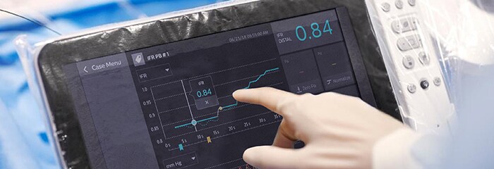 Finestra a comparsa trattamento cad ifr