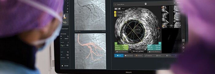 Finestra a comparsa trattamento cad intrasight