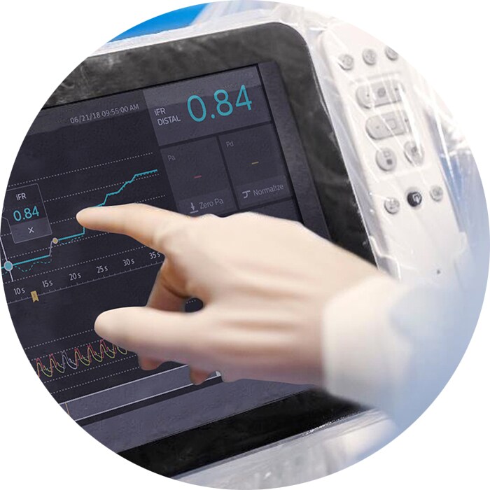 Monitoraggio avanzato del paziente con Philips IntelliVue