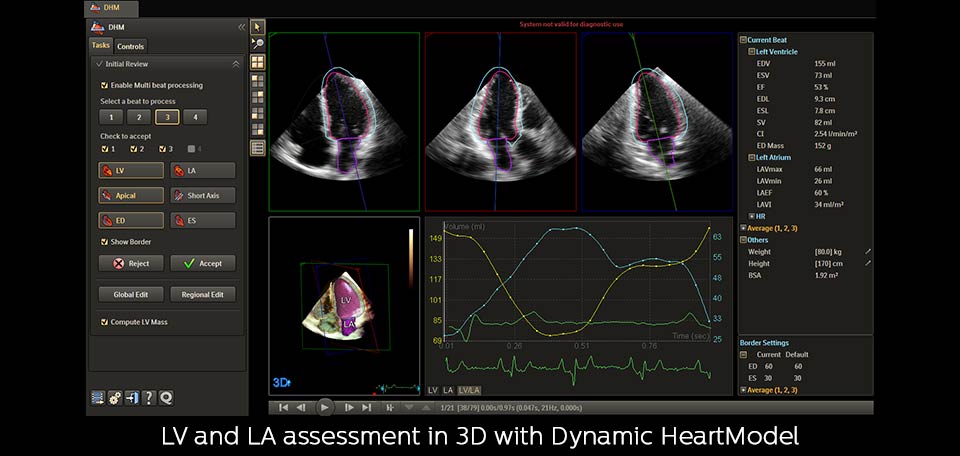 dhm analysis