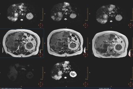 oncologia dell'area clinica