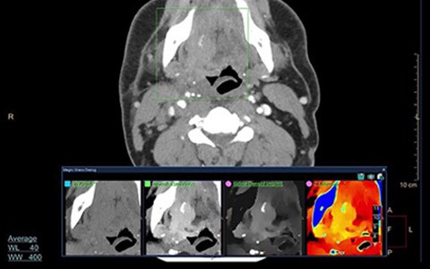 video spectral ct