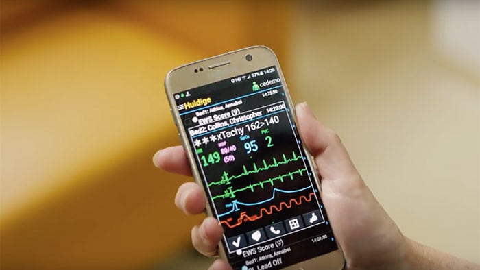 Video Utilizzo di dispositivi mobili per la gestione degli allarmi di monitoraggio con Philips CareEvent
