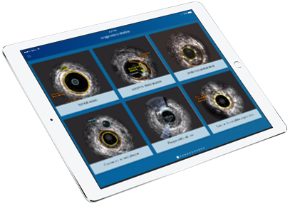 ipad esperto IVUS