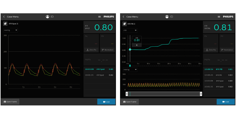 Immagine download monitor iFR