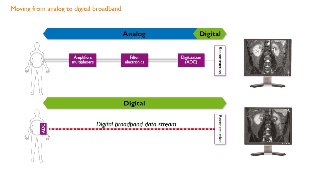 Dalla banda larga analogica a quella digitale