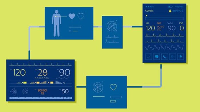 Supporto decisionale clinico - Philips