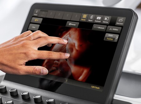 Imaging a ultrasuoni Philips per ostetricia con TrueVue.