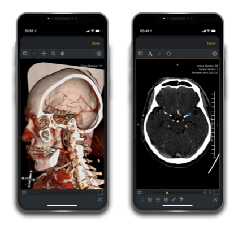 App di neurologia
