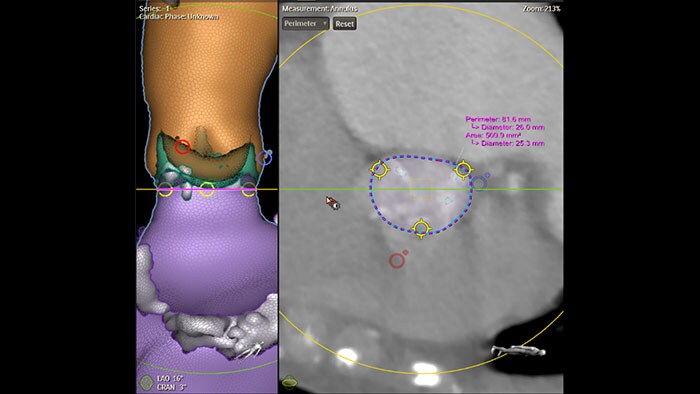 Immagine clinica di HeartNavigator