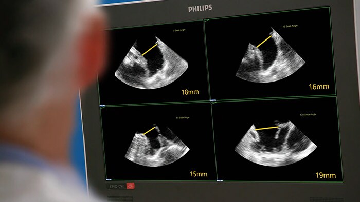 Sistema ecografico interventistico EPIQ CVxi