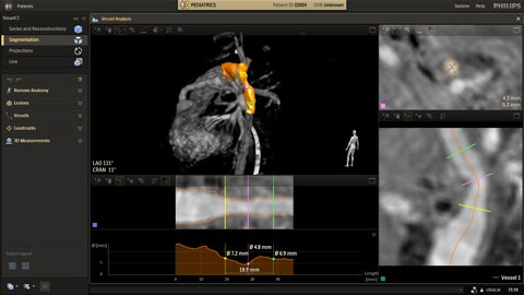 Maggiore sicurezza clinica con strumenti avanzati di visualizzazione e di misurazione in 3D