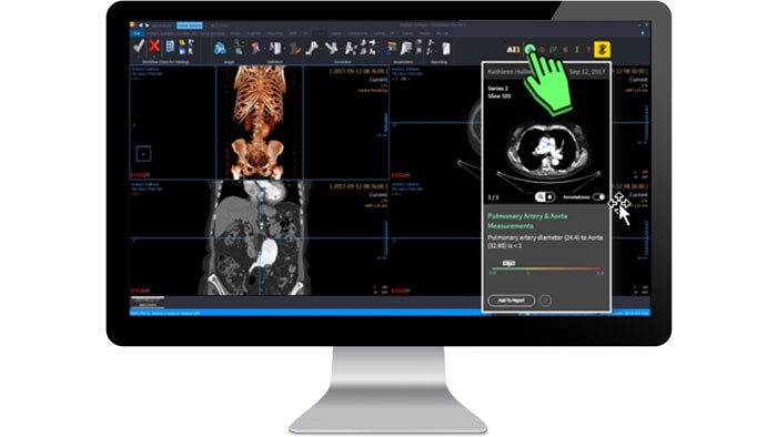 Schermata dell'interfaccia di analisi clinica su un monitor