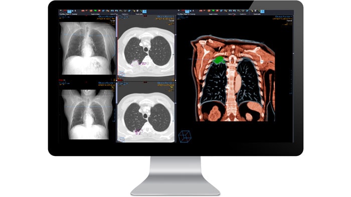 Schermata dell'interfaccia del modulo diagnostico radiologico su un monitor