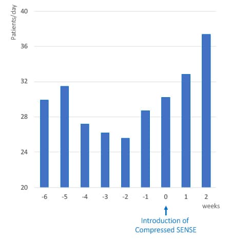 Introduzione alle statistiche di Compressed SENSE