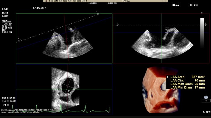 EPIQ CVx -TrueVue Glass con 3D Auto LAA