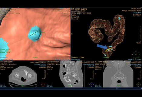 DynaCAD Prostate