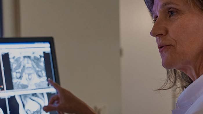 RM: una nuova visione per la radioterapia