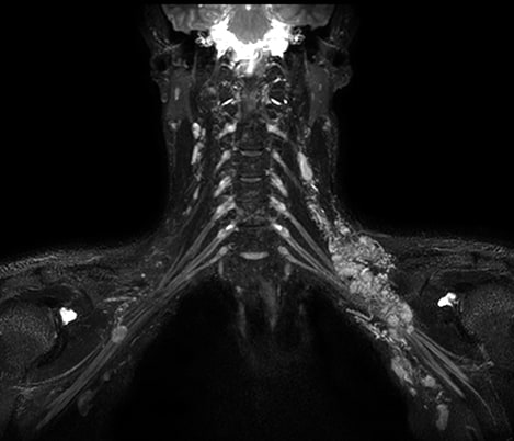 Anteprima del video 3d nerveview