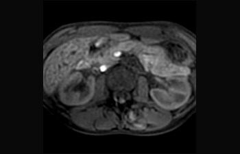 Fegato e pancreas