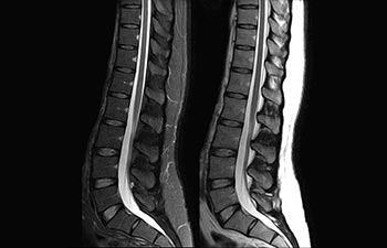 Colonna vertebrale