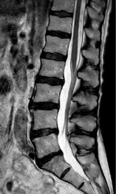 Imaging della colonna vertebrale PHH philips smartspeed