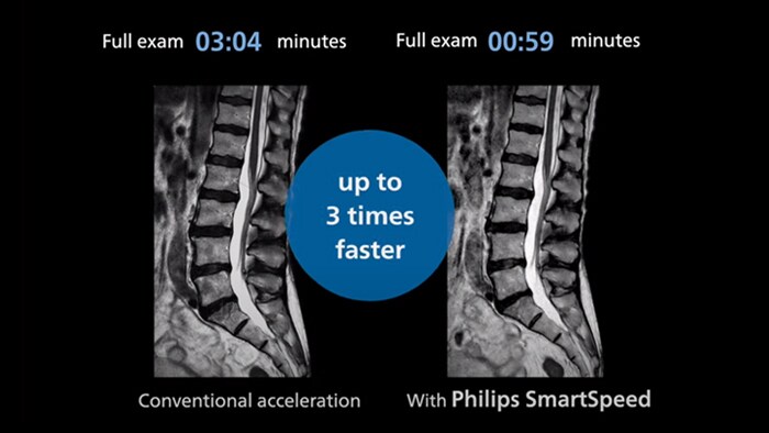 Anteprima del video con animazione SmartSpeed