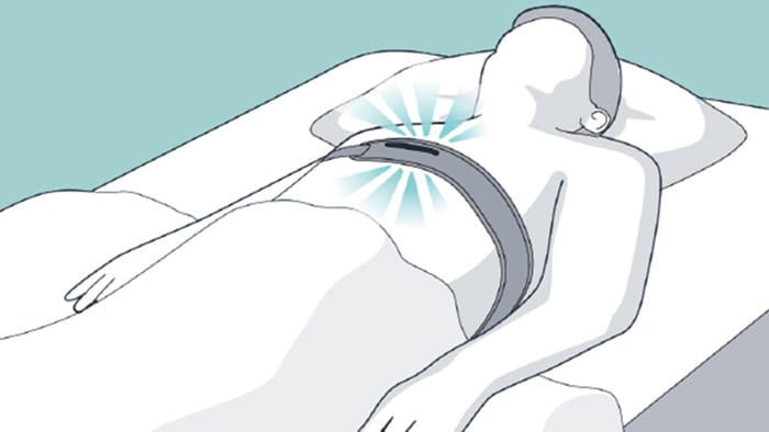 Illustrazione che mostra il paziente sdraiato supino.