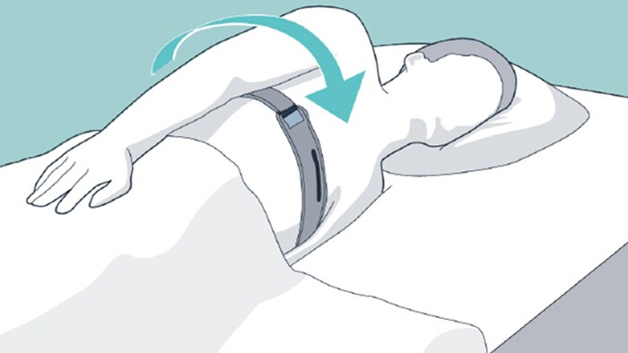 Illustrazione che mostra il paziente sdraiato sul fianco.