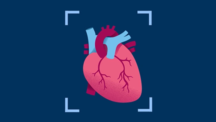Video applicazioni cardiache