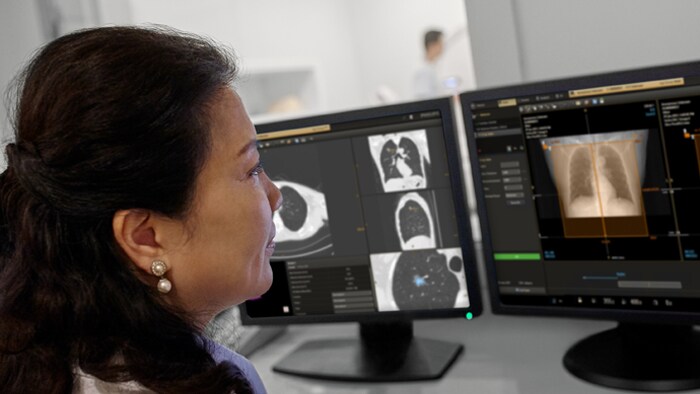 Ottieni i risultati che i radiologi desiderano mobile