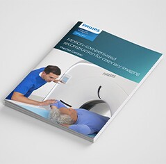 Imaging cardiaco preciso