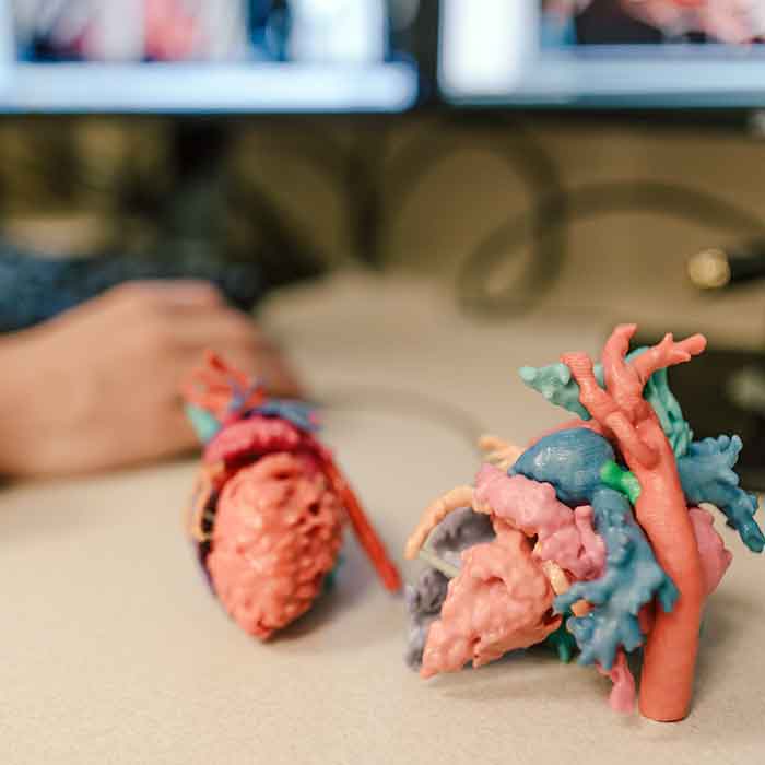 Il Cardiac 3D Print Lab a Phoenix