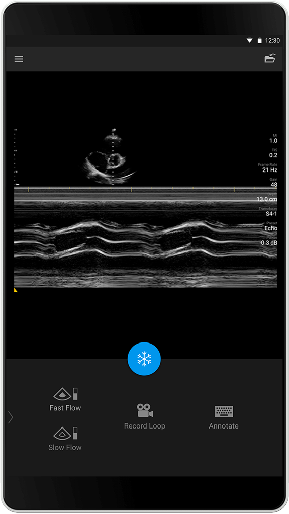 S4-1 Esame ecocardio