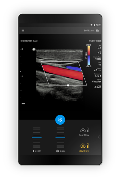 Tablet per imaging