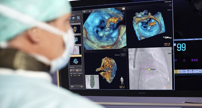 Migliorare la cardiologia utilizzando sistemi di imaging