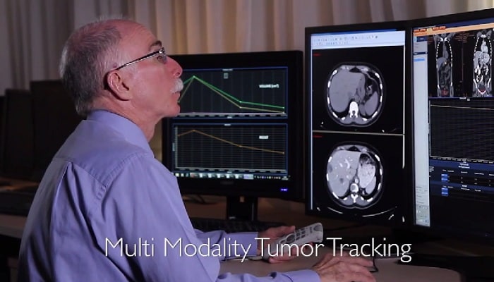 Valutare il trattamento attraverso la quantificazione: Multimodality Tumor Tracking su IntelliSpace Portal