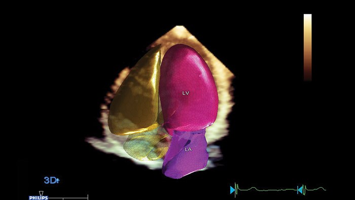 Anatomical intelligence for ultrasound