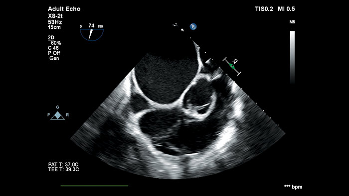 Trasduttori diagnostici transtoracici e transesofagei 2D e 3D